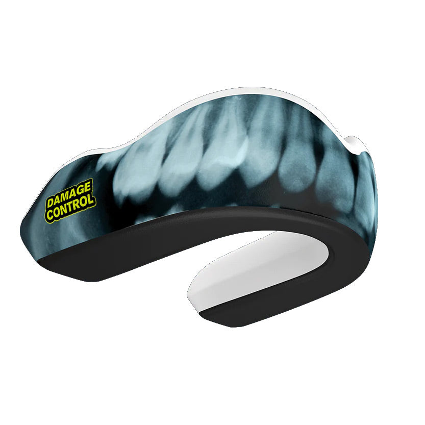 Damage Control Extreme Impact X-Ray Mouth Guard - The Fight Club